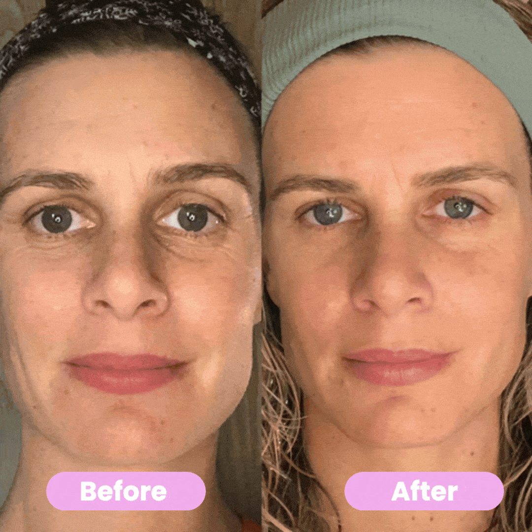 7-in-1 LED Facial Sculptor – Firm, Brighten & Rejuvenate Your Skin at Home