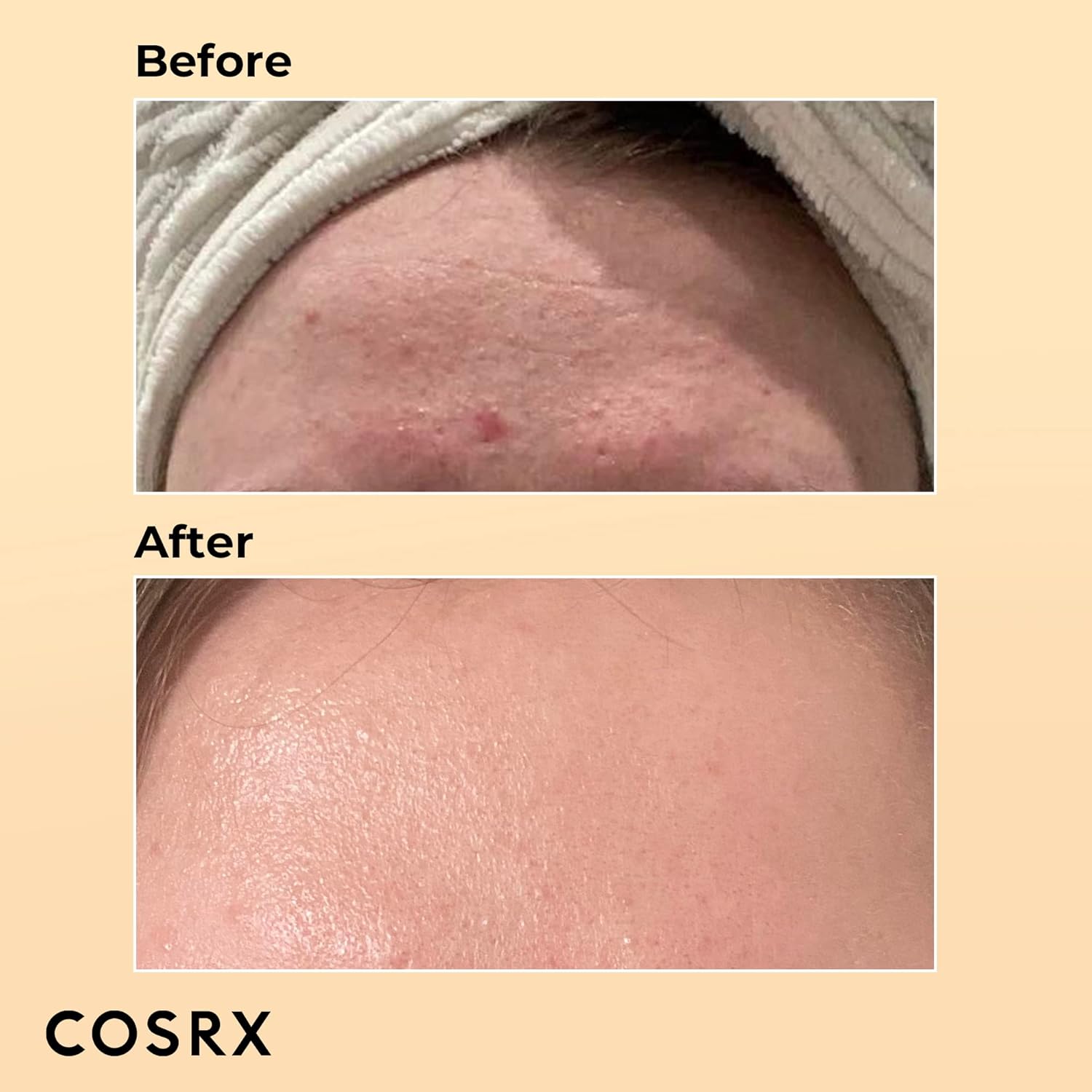 COSRX Snail Mucin 96% Power Repairing Essence (100ml)
