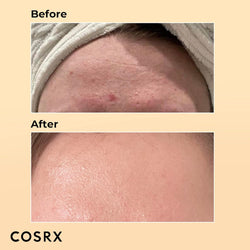 Image of COSRX Snail Mucin 96% Power Repairing Essence (100ml)