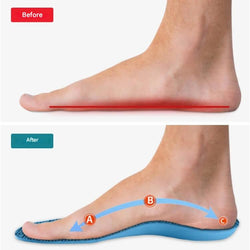 Image of Orthopaedic Insoles  Instant Comfort & Support for Foot Pain Relief