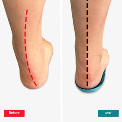 Image of Orthopaedic Insoles  Instant Comfort & Support for Foot Pain Relief
